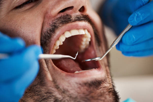Best Same-Day Emergency Dentist in Seco Mines, TX