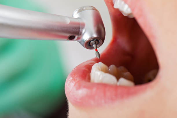 Best Pediatric Emergency Dentist in Seco Mines, TX